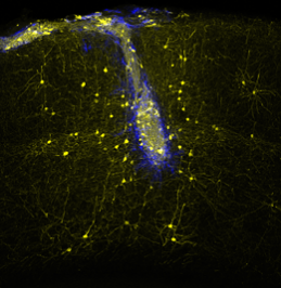 Neuronal transplants (blue) connect with host neurons (yellow) in the adult mouse brain in a highly specific manner, rebuilding neural networks lost upon injury. Picture: Sofia Grade (credit: LMU/Helmholtz Zentrum München)
