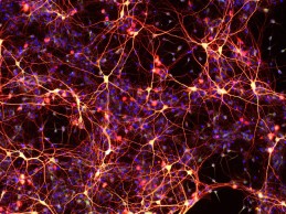 Neurons created from chemically-induced neural stem cells. The cells were created from skin cells that were reprogrammed into neural stem cells using a cocktail of only nine chemicals. This is the first time cellular reprogramming has been accomplished without adding external genes to the cells. (credit: Mingliang Zhang, PhD, Gladstone Institutes)
