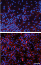 RMST Is Necessary for Neuronal Differentiation: overexpression of RMST led to a 3-fold increase in neuron-specific beta tubulin (bottom) compared to control (top)