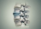 The UNSW researchers said the therapy has enormous potential for treating spinal disc injury and joint and muscle degeneration and could also speed up recovery following complex surgeries where bones and joints need to integrate with the body (credit: UNSW TV)