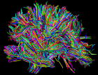 White matter in human brain (credit: David Shattuck, Arthur Toga, Paul Thompson/UCLA Lab of Neuro Imaging)