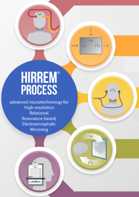 HIRREM process infographic ft