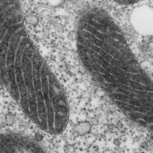 Electron microscope image of a mitochondrion