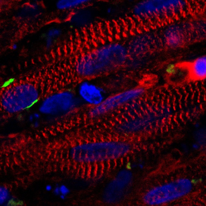 A stained cross section of the new muscle fibers. The red cells are muscle cells, the green areas are receptors for neuronal input, and the blue patches are cell nuclei. (credit: Duke University)
