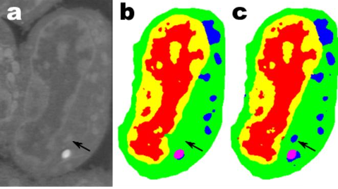 These are images of a slice of mouse lymphblastoid cells; a. is the raw data, b is the corresponding manual segmentation and c is the output of an MS-D network with 100 layers. (credit: Data from A. Ekman and C. Larabell, National Center for X-ray Tomography.)