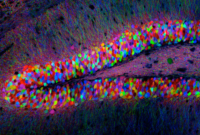 Mouse Hippocampus