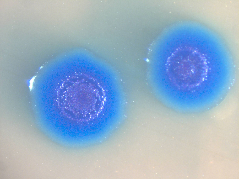 Mycoplasma_genitalium