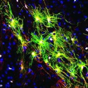 brain_mice_human_astrocytes