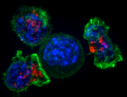 Killer T-cells surround a cancer cell (credit: NIH)