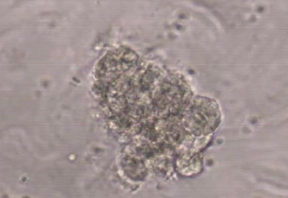 ucla_embryonic_stem_cells_heart