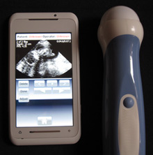An image of a fetus at 23 weeks is displayed on Mobisante’s phone-based ultrasound device. (Mobisante)